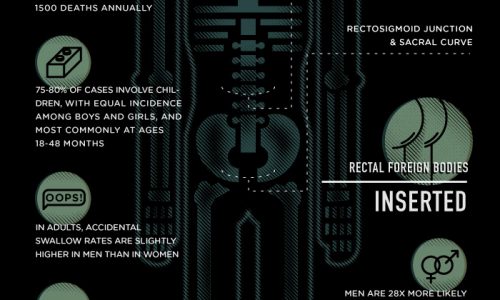 Most Obscure Objects Ingested or Inserted Infographic