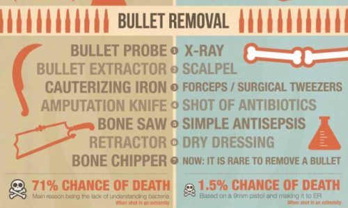 Medical Procedures Then And Now