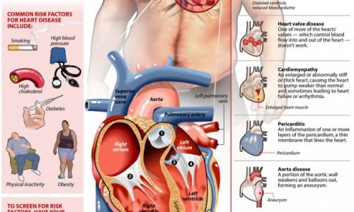 Heart Disease