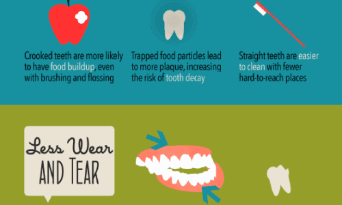 Benefits of Having Straight Teeth Infographic