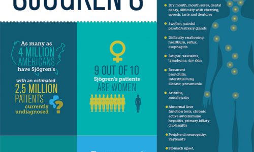 Symptoms and statistics of Sjogren’s Syndrome