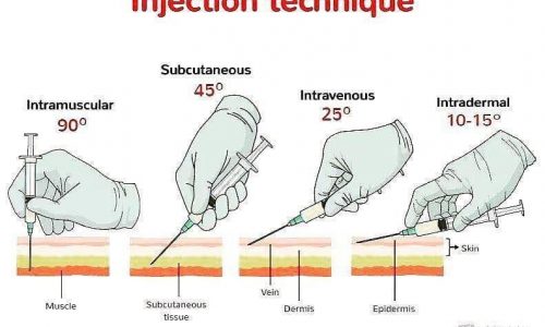 Injection Techniques