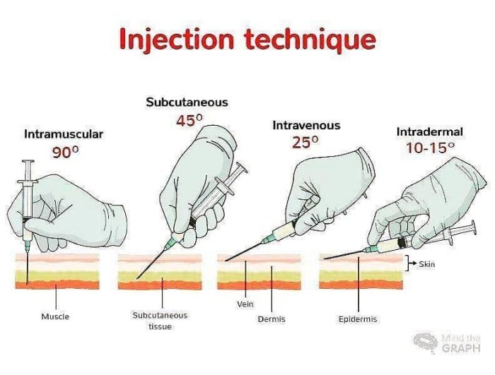 Injection Techniques