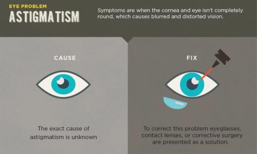 Common Eye Problems